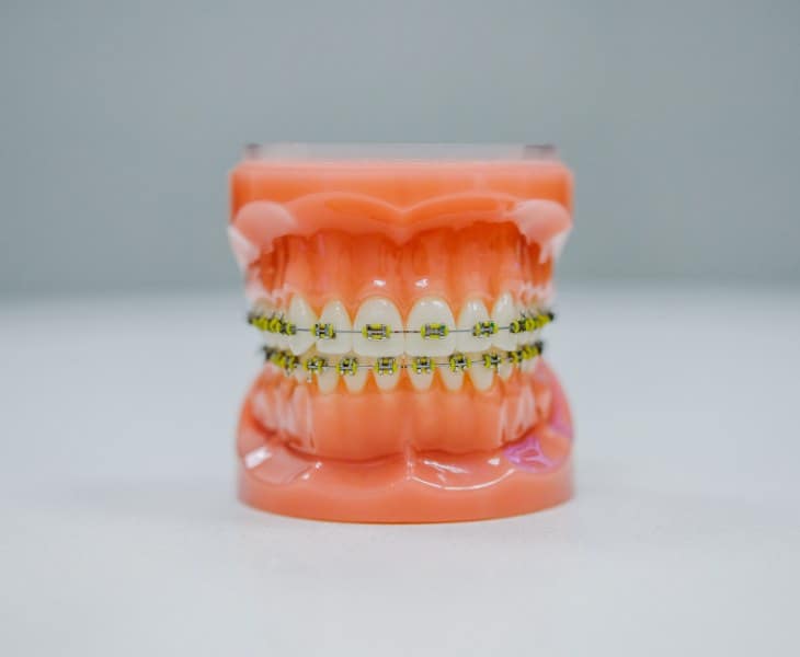 Jakie są najczęstsze przyczyny bólu zębów i jak sobie z nimi radzić?