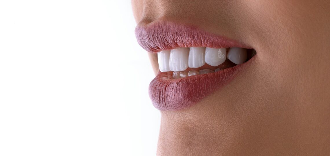 a close up of a woman's mouth with white teeth